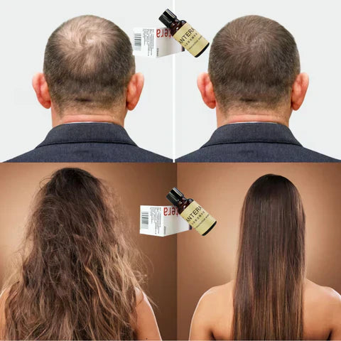 TONICO ANTERA CRECIMIENTO DE EL CABELLO